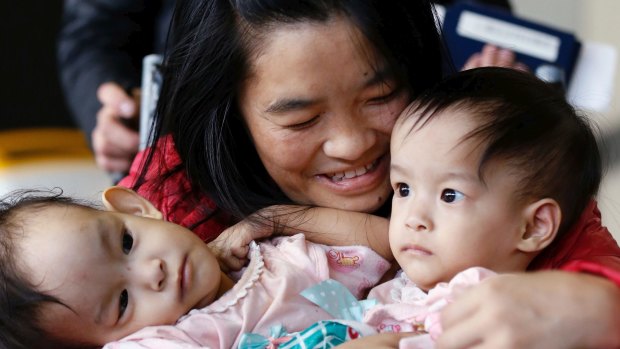 Surgeons at Melbourne's Royal Children's Hospital will attempt to separate 14-month-old conjoined twins, Nima and Dawa.