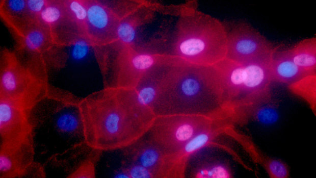 Researchers have found certain abnormalities can make cancers more - or less - deadly.