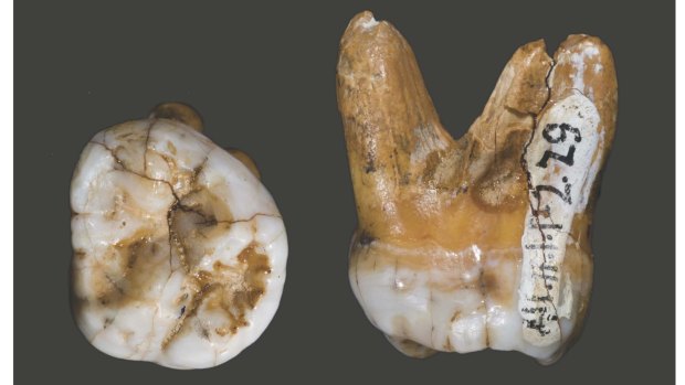A tooth of a Denisovan, found in a cave in Siberia. 