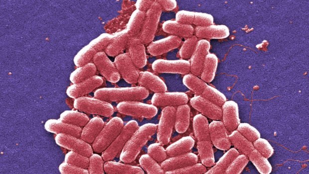 Superbugs, such as E.coli are resistant to many antibiotics