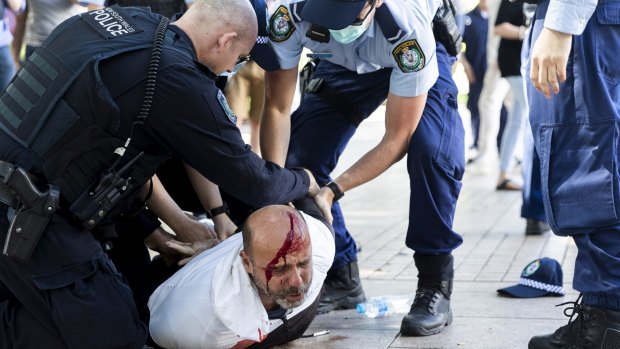 A man is seen bleeding profusely from a head wound incurred during a dramatic arrest in Hyde Park.