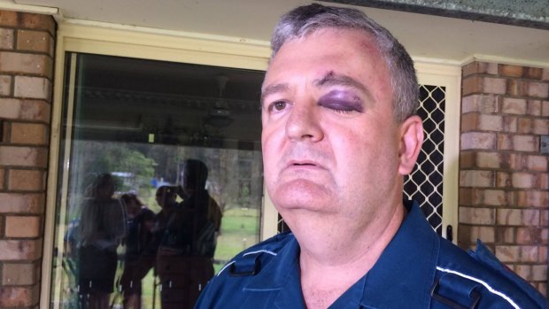 Paramedic Brad Johnson was allegedly bashed in the back of an ambulance by a patient in 2017.