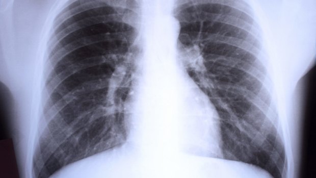 A simple change in how an X-ray is assessed could have big health outcomes for patients.