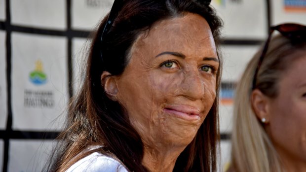 Turia Pitt's 'Monday morning' idea for a page that helps small businesses affected by the fires has had a massive response.