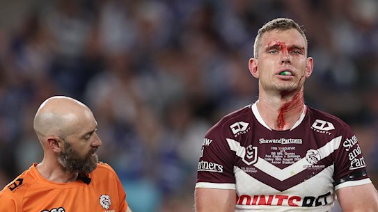 Tom Trbojevic leaves the field.