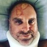 Former cricketer Matthew Hayden injured while surfing off Stradbroke