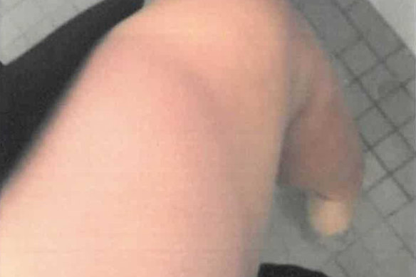 A photo tendered in court in Bruce Lehrmann’s defamation trial of what Brittany Higgins has described as a bruise on her leg.