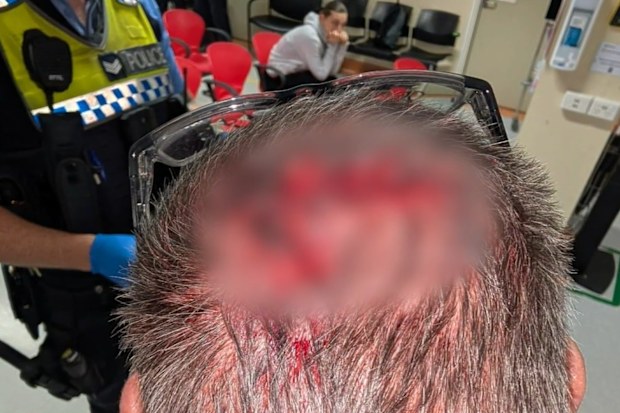 Anthony Godin was struck to the head, allegedly by a man with a golf stick in hand, as he sipped his coffee in Perth’s CBD.