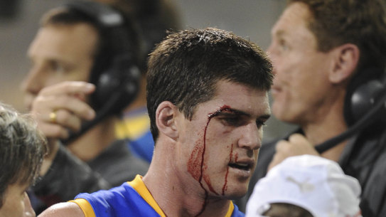 Former Brisbane Lions champion Jonathan Brown after a clash during a match against Carlton in 2009.