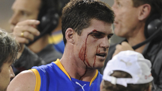 Former Brisbane Lions champion Jonathan Brown after a clash during a match against Carlton in 2009.