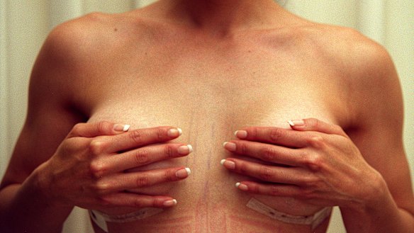 The textured implants have been associated with an elevated risk of anaplastic large cell lymphoma (ALCL).