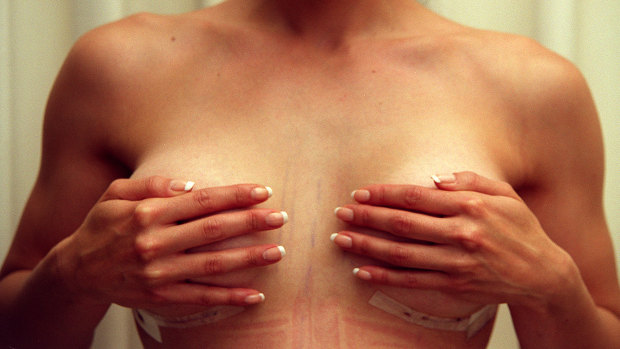 Breast Implant Illness (BII) is gaining notoriety as a catch-all for unexplained symptoms in women with breast implants.