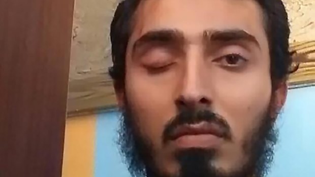 One-eyed Osman Haouchar, who is not accused of any wrongdoing.
