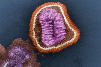 This negative-stained transmission electron microscopic (TEM) image depicts the ultrastructural details of an influenza virus particle.