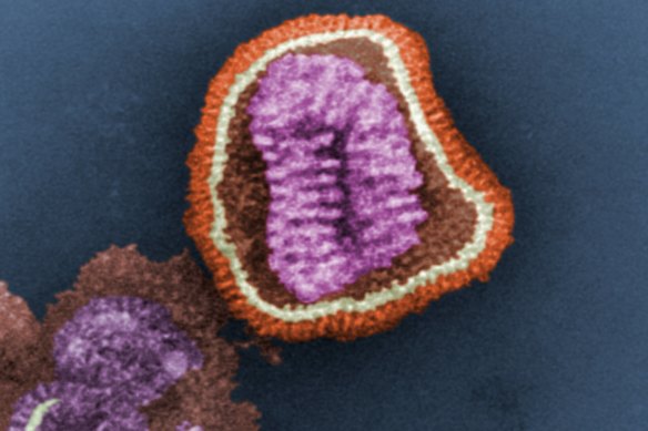 This negative-stained transmission electron microscopic (TEM) image depicts the ultrastructural details of an influenza virus particle.