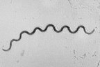 Syphilis is a highly contagious and potentially deadly STI caused by the Treponema pallidum bacterium.