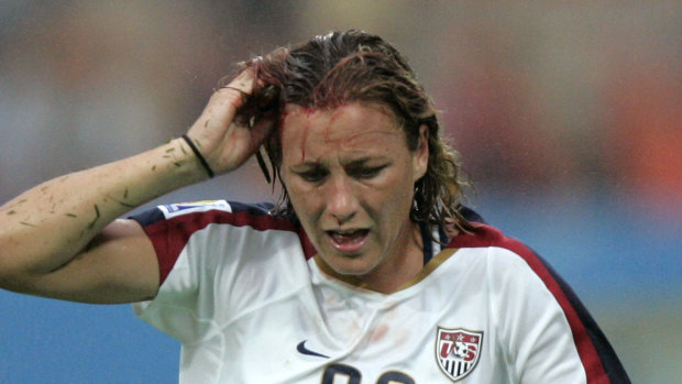 Abby Wambach after receiving a cut to the head during the World Cup in 2007.