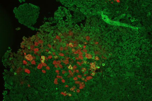 Liver cells treated by gene therapy during Lisowski’s research.