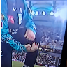 Kuhnemann suffered a nasty thumb injury in the Big Bash.