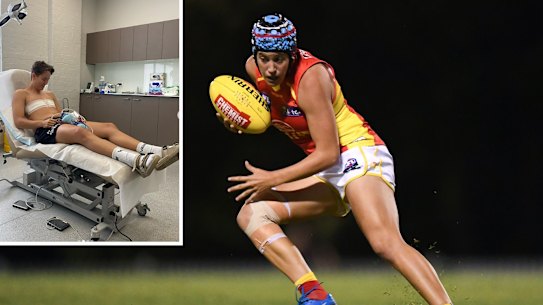 Former Gold Coast AFLW player Tori Groves-Little, and after her chest surgery.