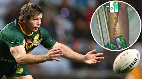 Harry Grant and injured leg