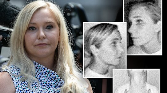 Os ferimentos de Virginia Giuffre em uma agressão de violência doméstica perpetrada por seu então marido, Robert Giuffre, no Colorado em 2015.  