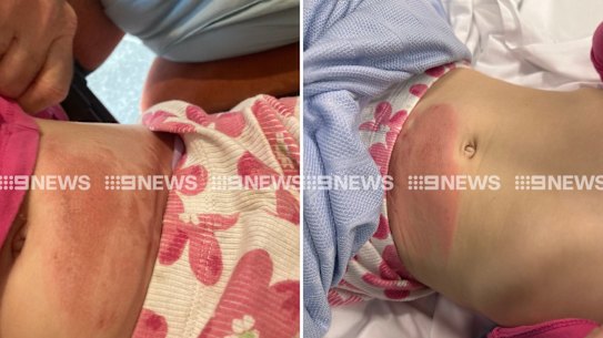 A four-year-old girl was injured in a traffic collision involving Broncos player Ezra Mam.