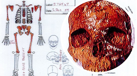 Composite image of the skeleton from the Australian Museum that is the subject of a coronial inquiry. 