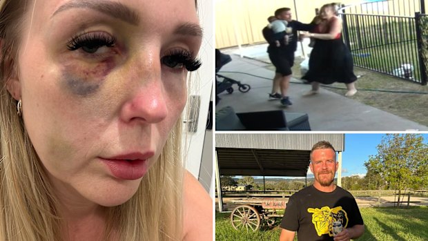 Chloe Wright was assaulted by her ex-partner, who has since been granted bail as he awaits sentencing.