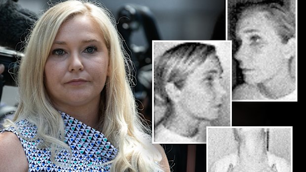 Virginia Giuffre’s injuries from a domestic violence assault by her then-husband Robert Giuffre in Colorado in 2015.  