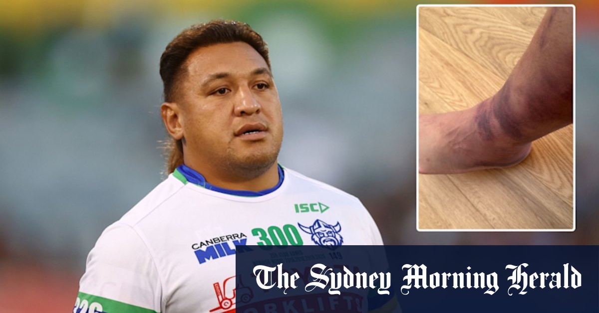 Raiders enforcer Josh Papalii reveals ankle injury scare ahead of Broncos qualifying final