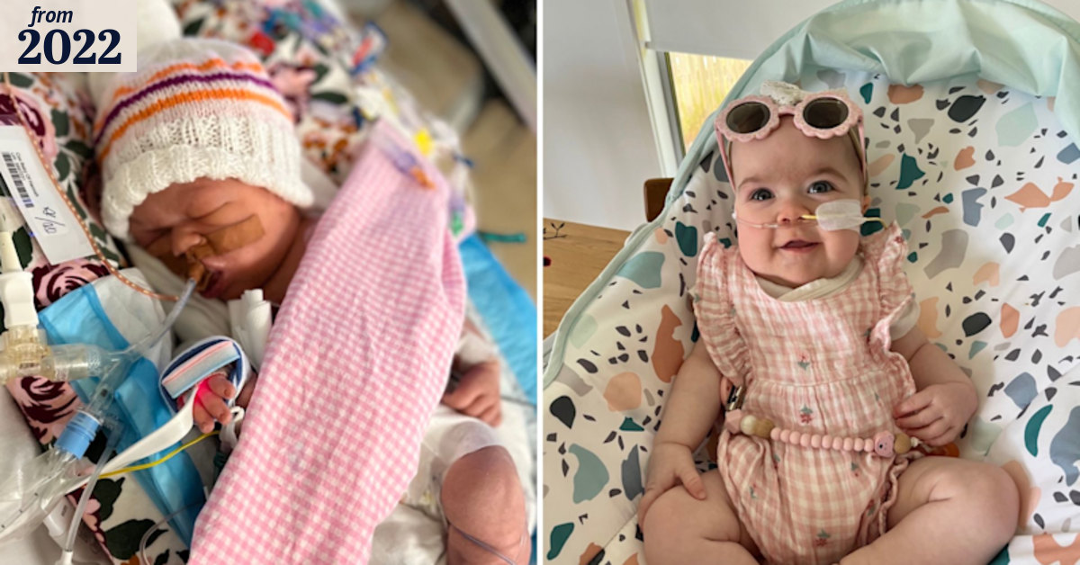 ‘It was a bleak time’: Baby born with organs outside body defies the odds