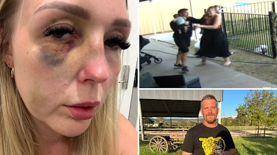 Chloe Wright was assaulted by her ex-partner, who has since been granted bail as he awaits sentencing. Pictures: Supplied