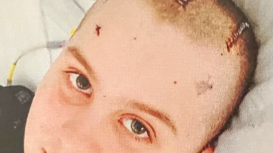 Max Shearer tinha apenas 11 anos quando os médicos descobriram uma forma rara de câncer no cérebro.