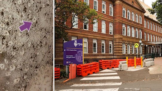 Mould at RPA index composite image