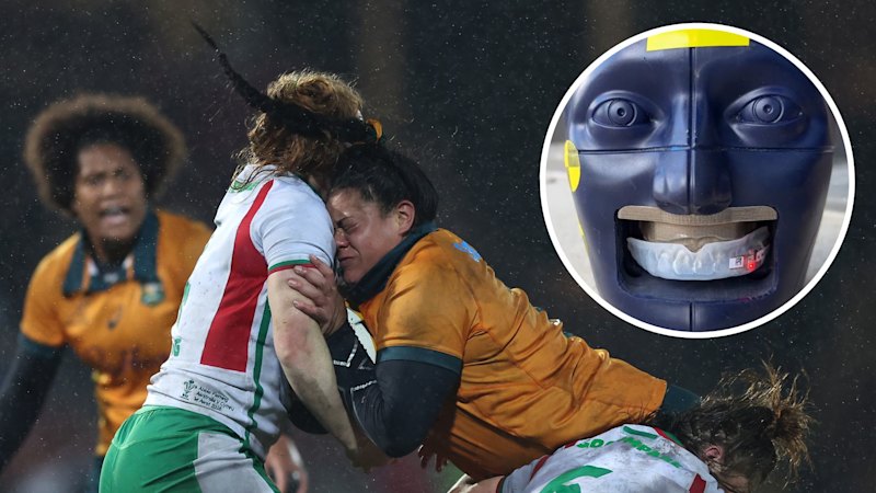 Red alert: Rugby to use mouthguards that flash after heavy impacts