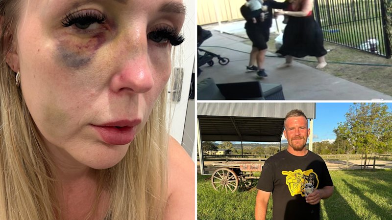 Violent serial DV offender cuts off ankle monitor, sparks police manhunt