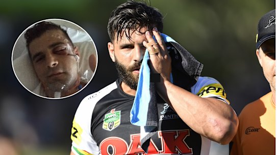 Josh Mansour suffered a face injury in 2018.