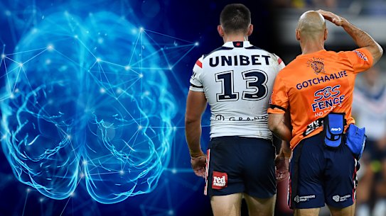 Concussion protocols vary from sport to sport.