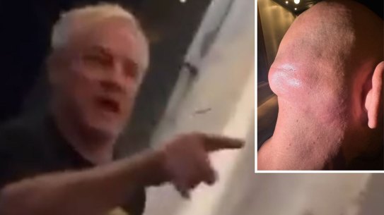 Paul Kent, left, and the bump left on Uzun’s head