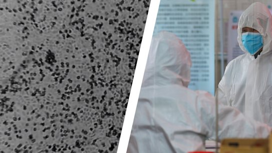 Doherty Institute screengrab of coronavirus and medical workers in Wuhan.