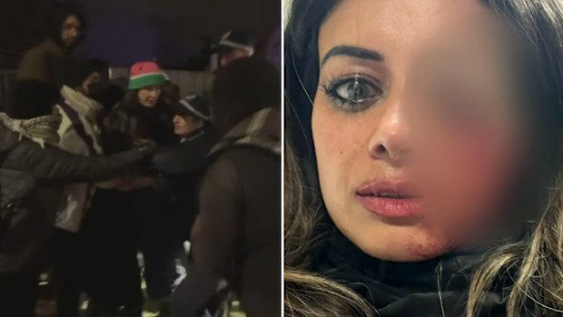 Hannah Thomas, a former Greens candidate, suffered a serious injury to her eye after police broke up a protest in Sydney’s south-west on Friday.
