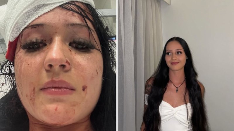 Waitress ‘put up hell of a fight’ against co-worker accused of attempted murder