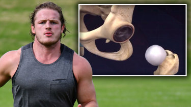George Burgess is back in the NRL after undergoing hip resurfacing surgery.