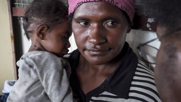 Sabeth Phillip and her malnourished child, Israel, at a health clinic in the remote highlands of Papua New Guinea.