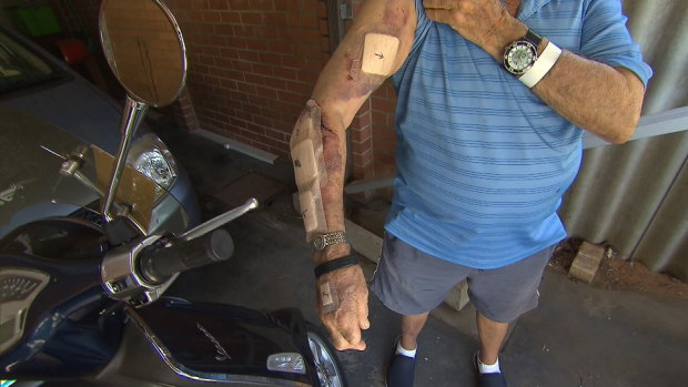 The 88-year-old received gashes to his arm which required several stitches. 