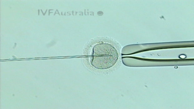 The IVF sector was subdued on Tuesday. 