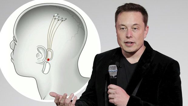 Elon Musk says his start-up has tested its elaborate interface of "threads" - which connects with a chip embedded in the skull - on rats and now wants to begin human trials as soon as next year.