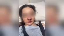 Teen hospitalised after alleged roadside attack during sleepover