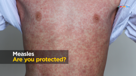 A new public health campaign is urging people to get vaccinated against measles, especially if you're travelling overseas.